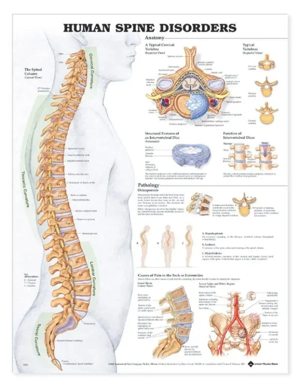 Human Spine Disorders Anatomical Chart [Book]